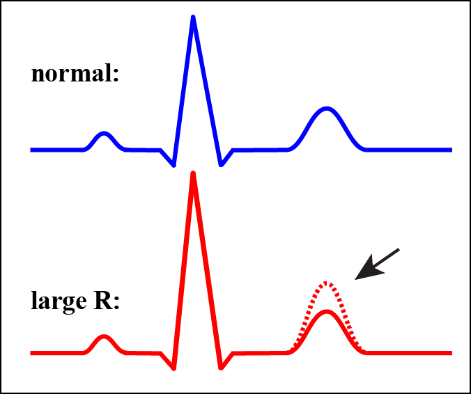 The shapes of the cardiac action potentials